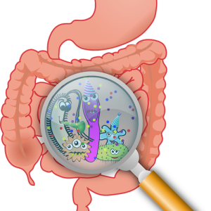 Intestin irritable, FODMAPS